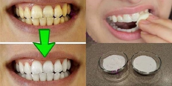 Garantuotas geltonų dantų balinimas vos per 2 minutes!